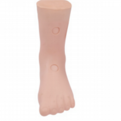 凹陷性水（shuǐ）腫模型