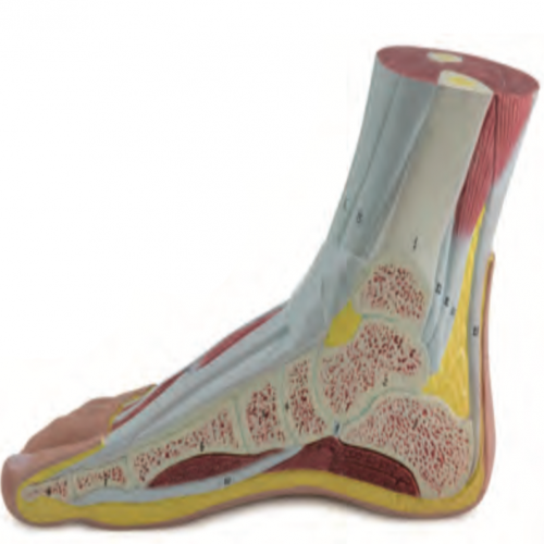 足正中失狀（zhuàng）切麵模型