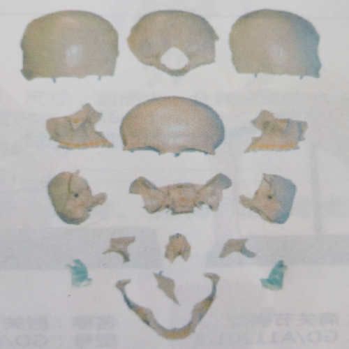 分離頭顱骨散（sàn）骨（gǔ）模型