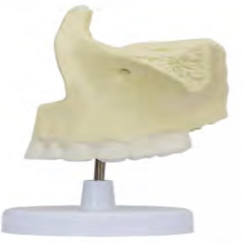 上頜骨（gǔ）放大模型（xíng）