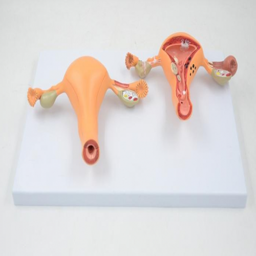 正常與病（bìng）理子宮對比模型