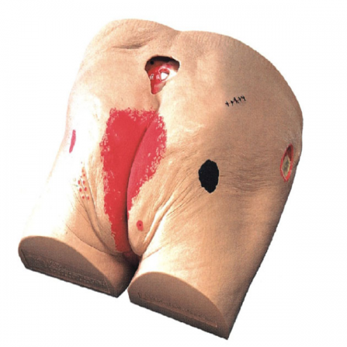 高級褥瘡護理（lǐ）模（mó）型