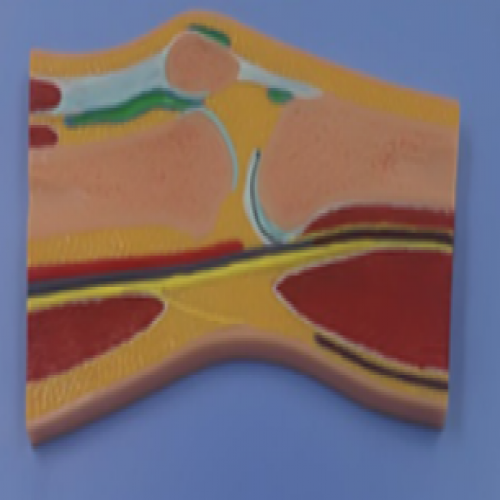 膝關節剖麵（miàn）模型