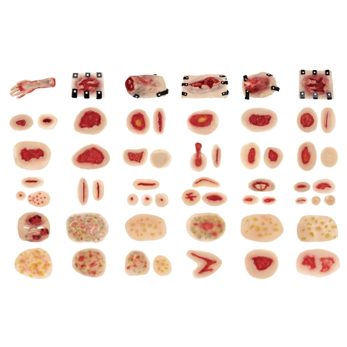 58部件創傷評估模塊