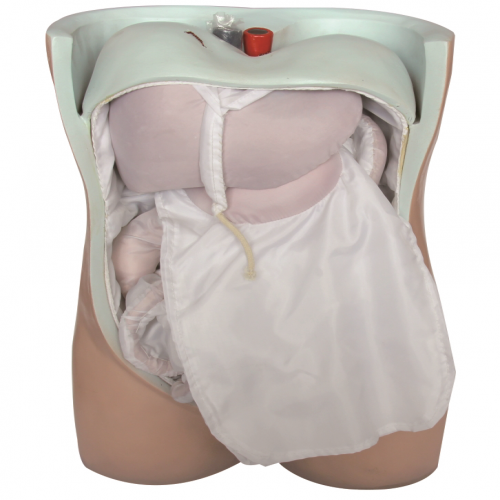 腹膜與內髒模（mó）型