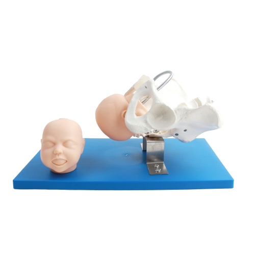 帶有胎兒頭的骨盆模型