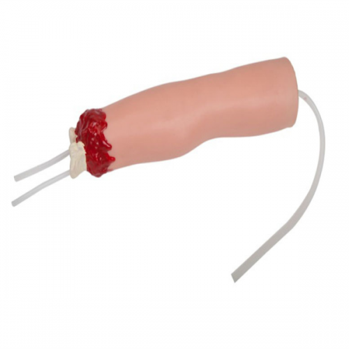 上肢外傷（shāng）斷肢止血模（mó）型