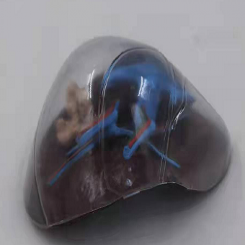 透（tòu）明肝髒模型