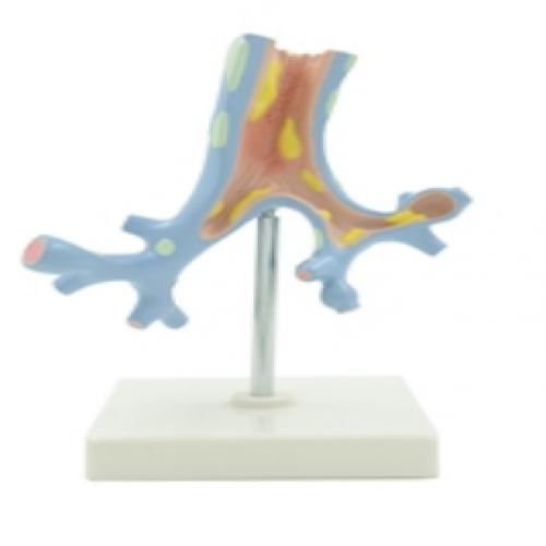 支氣管病（bìng）理病理模型