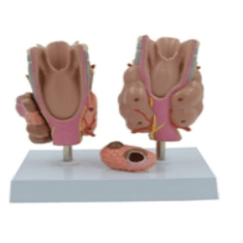 甲狀腺病理模型（xíng）