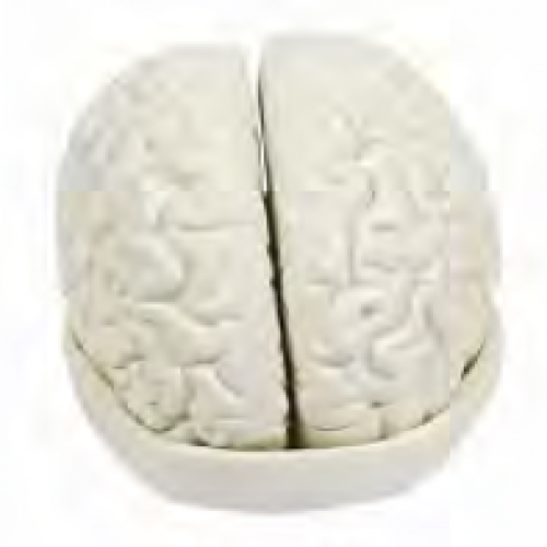 腦及腦室解（jiě）剖模型