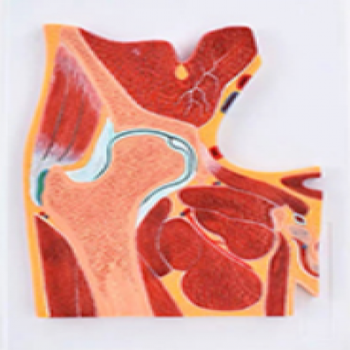 髖關節剖麵模型